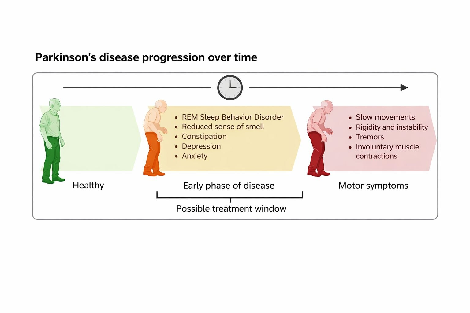 Disease progression over time for Parkinson's In the very earliest stages of Parkinson's, one of the most common symptoms is REM sleep behavior disorder, in which the person acts out their dreams during sleep, often through movements or sounds. An impaired sense of smell and depression are other possible symptoms at this stage. Credit: Annika Polster/ Created in BioRender